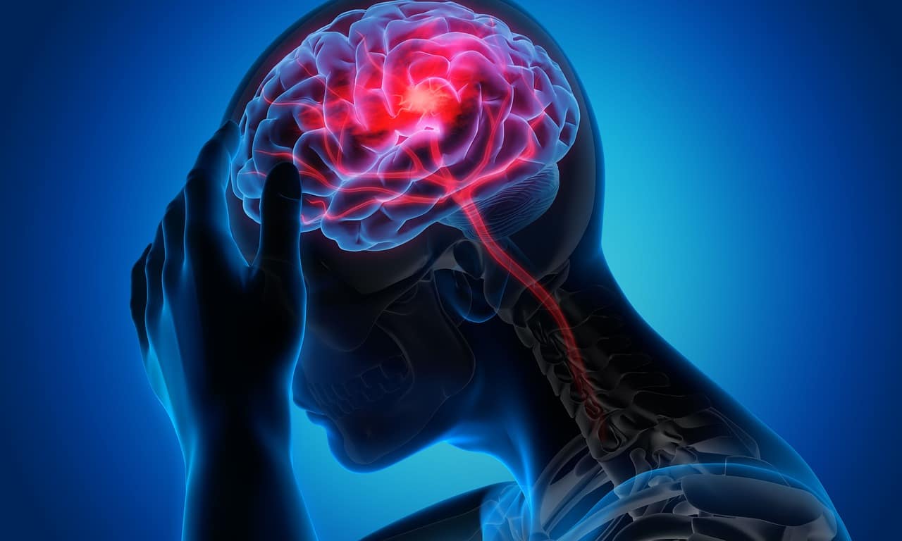 Brain Haemorrhagic Stroke