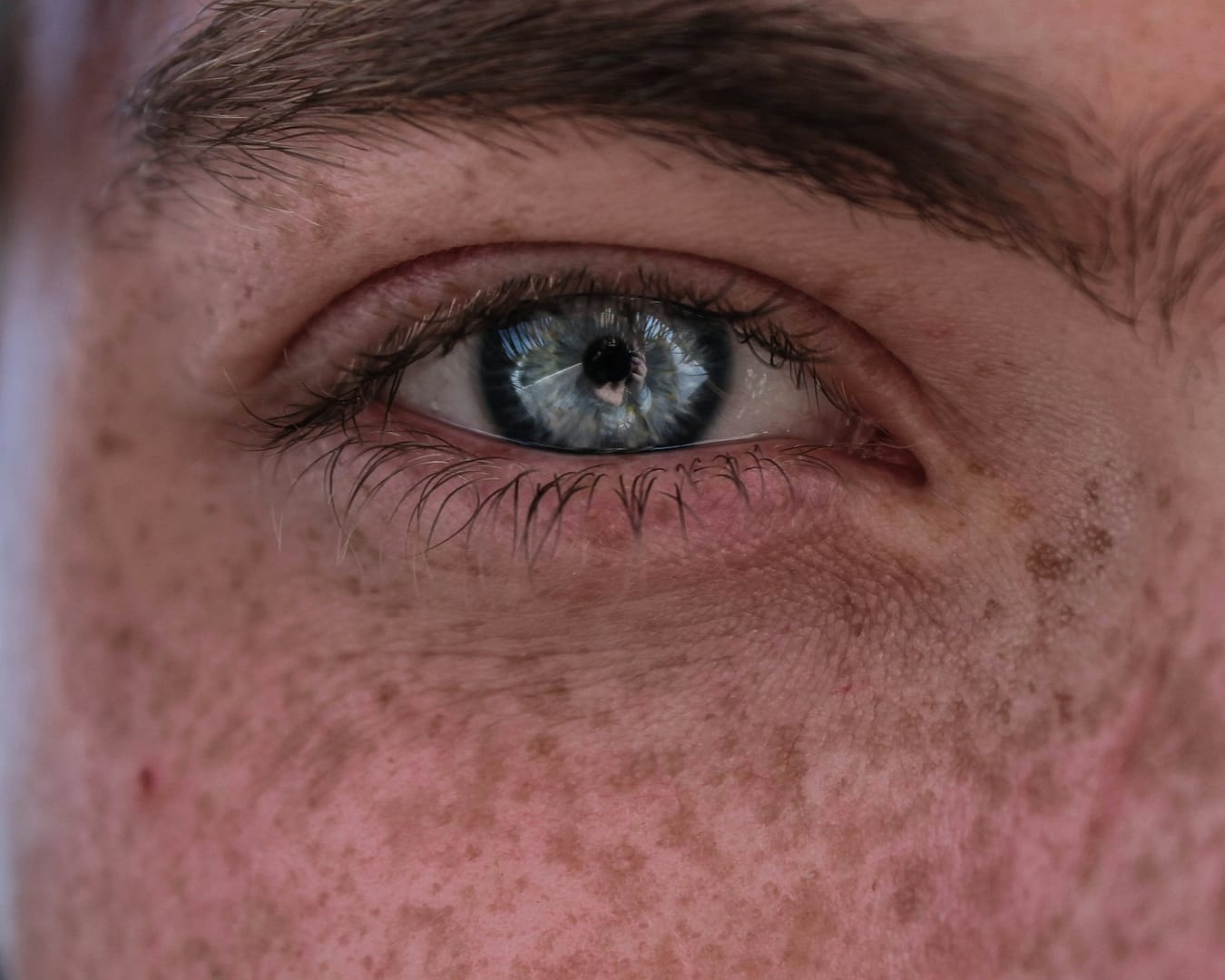 Hyperpigmentation Treatment : Skincare Ingredients Backed by Science